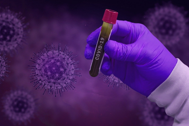 A világban már 30 millió fölött van a fertőzöttek száma, a felgyógyultaké pedig 20,4 millió